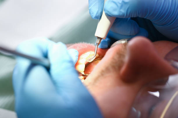 Best Broken or Cracked Tooth Emergency Dentist in Edwardsburg, MI