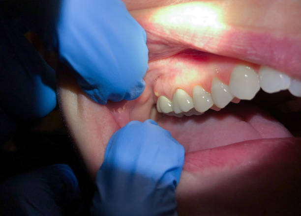 Best Pediatric Emergency Dentist in Edwardsburg, MI