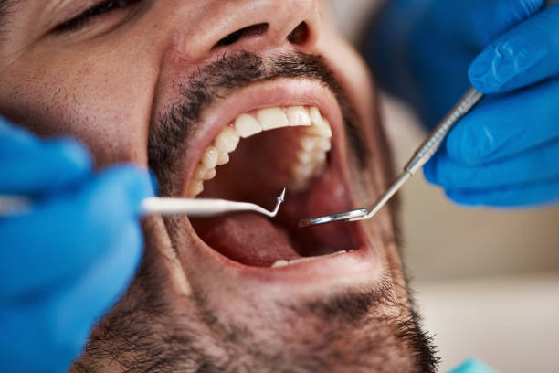 Best Mobile Emergency Dentist in Edwardsburg, MI