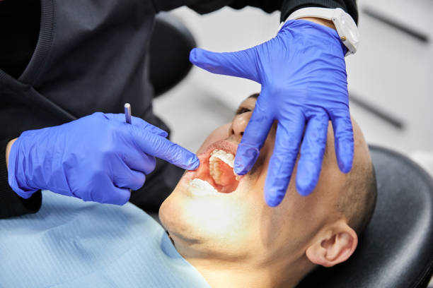 Best Emergency Dentist for Lost Fillings or Crowns in Edwardsburg, MI